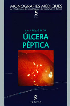 Úlcera Pèptica - 1993
